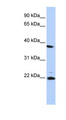 PSMB2 Antibody - PSMB2 antibody Western blot of HepG2 cell lysate. This image was taken for the unconjugated form of this product. Other forms have not been tested.