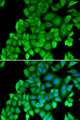 PSMB4 Antibody - Immunofluorescence analysis of MCF-7 cells.