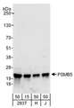 PSMB5 Antibody - Detection of Human PSMB5 by Western Blot. Samples: Whole cell lysate from 293T (15 and 50 ug), HeLa (H; 50 ug), and Jurkat (J; 50 ug) cells. Antibodies: Affinity purified rabbit anti-PSMB5 antibody used for WB at 0.1 ug/ml. Detection: Chemiluminescence with an exposure time of 10 seconds.