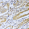PSMB5 Antibody - Immunohistochemical analysis of PSMB5 staining in human stomach formalin fixed paraffin embedded tissue section. The section was pre-treated using heat mediated antigen retrieval with sodium citrate buffer (pH 6.0). The section was then incubated with the antibody at room temperature and detected using an HRP conjugated compact polymer system. DAB was used as the chromogen. The section was then counterstained with hematoxylin and mounted with DPX.