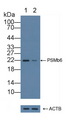 PSMB6 Antibody - Knockout Varification: Lane 1: Wild-type Hela cell lysate; Lane 2: PSMb6 knockout Hela cell lysate; Predicted MW: 25kd Observed MW: 22kd Primary Ab: 1µg/ml Rabbit Anti-Human PSMb6 Antibody Second Ab: 0.2µg/mL HRP-Linked Caprine Anti-Rabbit IgG Polyclonal Antibody