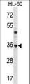 PSMB8 / LMP7 Antibody - PSMB8 Antibody western blot of HL-60 cell line lysates (35 ug/lane). The PSMB8 antibody detected the PSMB8 protein (arrow).
