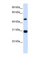 PSMC3 Antibody - PSMC3 antibody Western blot of Placenta lysate. This image was taken for the unconjugated form of this product. Other forms have not been tested.