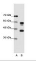 PSMC5 / SUG1 Antibody - A: Marker, B: Jurkat Cell Lysate.  This image was taken for the unconjugated form of this product. Other forms have not been tested.