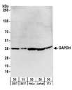 PSMD1 Antibody - Detection of human and mouse GAPDH by western blot. Samples: Whole cell lysate from HEK293T (15 and 50 µg), HeLa (50µg), Jurkat (50µg), and mouse NIH 3T3 (50µg) cells. Antibodies: Affinity purified goat anti-GAPDH antibody used for WB at 1 µg/ml. Detection: Chemiluminescence with an exposure time of 30 seconds.