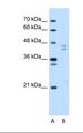 PSMD11 Antibody - Lane A: Marker. Lane B: HepG2 cell lysate. Antibody concentration: 5.0 ug/ml. Gel concentration: 12%.  This image was taken for the unconjugated form of this product. Other forms have not been tested.