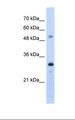 PSME3 Antibody - HepG2 cell lysate. Antibody concentration: 1.25 ug/ml. Gel concentration: 12%.  This image was taken for the unconjugated form of this product. Other forms have not been tested.
