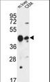 PSPLA1 / Phospholipase A1 Antibody - PLA1A Antibody western blot of mouse liver tissue and CEM cell line lysates (35 ug/lane). The PLA1A antibody detected the PLA1A protein (arrow).