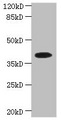 PSTK Antibody - Western blot All lanes: PSTK antibody at 5µg/ml + Hela whole cell lysate Secondary Goat polyclonal to rabbit IgG at 1/10000 dilution Predicted band size: 40, 33 kDa Observed band size: 40 kDa
