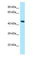 PSTPIP1 Antibody - PSTPIP1 antibody Western Blot of Fetal Liver.  This image was taken for the unconjugated form of this product. Other forms have not been tested.