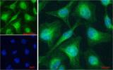 PTCH1 / Patched 1 Antibody - PTCH1 / Patched 1 antibody immunofluorescence analysis of paraformaldehyde fixed HeLa cells, permeabilized with 0.15% Triton. Primary incubation 1hr (5ug/ml) followed by Alexa Fluor 488 secondary antibody (1ug/ml), showing cytoplasmic and Golgi apparatus staining. The nuclear stain is DAPI (blue). Negative control: Unimmunized goat IgG (10ug/ml) followed by Alexa Fluor 488 secondary antibody (4ug/ml).