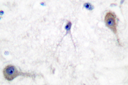 PTCH1 / Patched 1 Antibody - IHC of Patched (A2) pAb in paraffin-embedded human brain tissue.