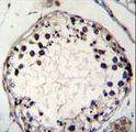 PTCHD3 Antibody - PTCHD3 Antibody immunohistochemistry of formalin-fixed and paraffin-embedded human testis tissue followed by peroxidase-conjugated secondary antibody and DAB staining.