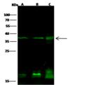 PTF1A Antibody - Anti-PTF1A rabbit polyclonal antibody at 1:500 dilution. Lane A: Jurkat Whole Cell Lysate. Lane B: K562 Whole Cell Lysate. Lane C: MCF7 Whole Cell Lysate. Lysates/proteins at 30 ug per lane. Secondary: Goat Anti-Rabbit IgG H&L (Dylight 800) at 1/10000 dilution. Developed using the Odyssey technique. Performed under reducing conditions. Predicted band size: 35 kDa. Observed band size: 38 kDa. (We are unsure as to the identity of these extra bands.)