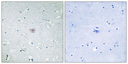 PTGER3 / EP3 Antibody - Immunohistochemistry analysis of paraffin-embedded human brain tissue, using PE2R3 Antibody. The picture on the right is blocked with the synthesized peptide.