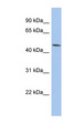 PTGER3 / EP3 Antibody - PTGER3 / EP3 antibody Western blot of HT1080 cell lysate. This image was taken for the unconjugated form of this product. Other forms have not been tested.