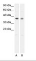 PTGER3 / EP3 Antibody - A. Jurkat Cell Lysate B. HepG2 Cell Lysate.  This image was taken for the unconjugated form of this product. Other forms have not been tested.