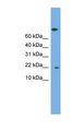 PTGES3 / p23 Antibody - PTGES3 antibody Western blot of COLO205 cell lysate. This image was taken for the unconjugated form of this product. Other forms have not been tested.