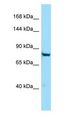 PTGFRN Antibody - PTGFRN antibody Western Blot of HepG2.  This image was taken for the unconjugated form of this product. Other forms have not been tested.
