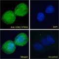 PTGS2 / COX2 / COX-2 Antibody - PTGS2 / COX2 antibody immunofluorescence analysis of paraformaldehyde fixed HepG2 cells, permeabilized with 0.15% Triton. Primary incubation 1hr (10ug/ml) followed by Alexa Fluor 488 secondary antibody (2ug/ml), showing cytoplasmic/vesicle staining. The nuclear stain is DAPI (blue). Negative control: Unimmunized goat IgG (10ug/ml) followed by Alexa Fluor 488 secondary antibody (2ug/ml).