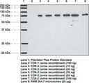 PTGS2 / COX2 / COX-2 Antibody - Western blot of COX-2 antibody.