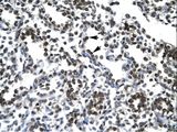 PTHLH / PTHRP Antibody - PTHLH / PTHRP antibody ARP33885_T100-NP_002811-PTHLH (parathyroid hormone-like hormone) Antibody was used in IHC to stain formalin-fixed, paraffin-embedded human lung.  This image was taken for the unconjugated form of this product. Other forms have not been tested.