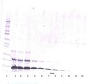 PTHLH / PTHRP Antibody - Western Blot (reducing) of PTHRP antibody