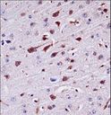 PTK2B / PYK2 Antibody - Mouse Ptk2b Antibody immunohistochemistry of formalin-fixed and paraffin-embedded mouse brain tissue followed by peroxidase-conjugated secondary antibody and DAB staining.