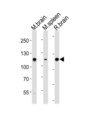 PTK2B / PYK2 Antibody - Western blot of lysates from mouse brain, mouse spleen, rat brain tissue (from left to right) with Ptk2b Antibody (P769). Antibody was diluted at 1:1000 at each lane. A goat anti-rabbit IgG H&L (HRP) at 1:10000 dilution was used as the secondary antibody. Lysates at 20 ug per lane.
