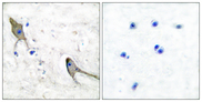 PTK2B / PYK2 Antibody - Immunohistochemistry analysis of paraffin-embedded human brain tissue, using PYK2 Antibody. The picture on the right is blocked with the synthesized peptide.