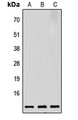 PTMA / Prothymosin Alpha Antibody - Western blot analysis of Prothymosin alpha expression in HeLa (A); Raw264.7 (B); PC12 (C) whole cell lysates.