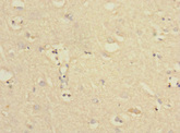 PTPN18 Antibody - Immunohistochemistry of paraffin-embedded human brain tissue at dilution 1:100