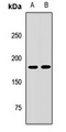 PTPN23 / HDPTP Antibody