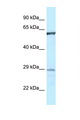 PTPN6 / SHP1 Antibody - PTPN6 antibody Western blot of 1 Cell lysate. Antibody concentration 1 ug/ml.  This image was taken for the unconjugated form of this product. Other forms have not been tested.