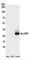 PTPRCAP / CD45 AP Antibody - Detection of Human LPAP by Western Blot. Samples: Whole cell lysate (50 ug) prepared using NETN buffer from HeLa, 293T, and Jurkat cells. Antibodies: Affinity purified rabbit anti-LPAP antibody used for WB at 0.1 ug/ml. Detection: Chemiluminescence with an exposure time of 30 seconds.