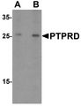 PTPRD / RPTP-Delta Antibody - Western blot analysis of PTPRD in HeLa cell lysate with PTPRD antibody at (A) 1 and (B) 2 ug/ml.