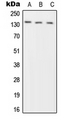 PTPRN2 / Phogrin Antibody - Western blot analysis of Phogrin expression in HeLa (A); SP2/0 (B); H9C2 (C) whole cell lysates.