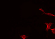 PTPRZ1 / Phosphacan Antibody - Staining A549 cells by IF/ICC. The samples were fixed with PFA and permeabilized in 0.1% Triton X-100, then blocked in 10% serum for 45 min at 25°C. The primary antibody was diluted at 1:200 and incubated with the sample for 1 hour at 37°C. An Alexa Fluor 594 conjugated goat anti-rabbit IgG (H+L) Ab, diluted at 1/600, was used as the secondary antibody.