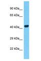 PTRF / CAVIN Antibody - PTRF / CAVIN antibody Western Blot of MCF7. Antibody dilution: 1 ug/ml.  This image was taken for the unconjugated form of this product. Other forms have not been tested.