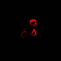 PTRH2 / BIT1 Antibody - Immunofluorescent analysis of PTRH2 staining in MCF7 cells. Formalin-fixed cells were permeabilized with 0.1% Triton X-100 in TBS for 5-10 minutes and blocked with 3% BSA-PBS for 30 minutes at room temperature. Cells were probed with the primary antibody in 3% BSA-PBS and incubated overnight at 4 deg C in a humidified chamber. Cells were washed with PBST and incubated with a DyLight 594-conjugated secondary antibody (red) in PBS at room temperature in the dark.