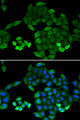 PTS Antibody - Immunofluorescence analysis of MCF-7 cells.
