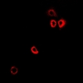 PTS Antibody - Immunofluorescent analysis of PTPS staining in MCF7 cells. Formalin-fixed cells were permeabilized with 0.1% Triton X-100 in TBS for 5-10 minutes and blocked with 3% BSA-PBS for 30 minutes at room temperature. Cells were probed with the primary antibody in 3% BSA-PBS and incubated overnight at 4 deg C in a humidified chamber. Cells were washed with PBST and incubated with a DyLight 594-conjugated secondary antibody (red) in PBS at room temperature in the dark.