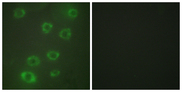 PTX3 / Pentraxin 3 Antibody - Immunofluorescence analysis of HUVEC cells, using PTX3 Antibody. The picture on the right is blocked with the synthesized peptide.