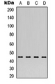 PTX3 / Pentraxin 3 Antibody - Western blot analysis of PTX3 expression in SHSY5Y (A); 293T (B); NIH3T3 (C); rat muscle (D) whole cell lysates.
