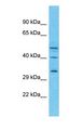 PTX4 / Pentraxin 4 Antibody - Western blot of PTX4 Antibody with OVCAR-3 Whole Cell lysate.  This image was taken for the unconjugated form of this product. Other forms have not been tested.