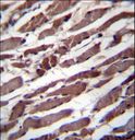PUS1 Antibody - PUS1 Antibody immunohistochemistry of formalin-fixed and paraffin-embedded human skeletal muscle followed by peroxidase-conjugated secondary antibody and DAB staining.