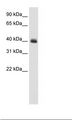 PUS1 Antibody - Sp2/0 Cell Lysate.  This image was taken for the unconjugated form of this product. Other forms have not been tested.