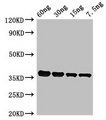 Putative L-asparaginase Antibody - Western Blot Positive WB detected in Recombinant protein All lanes: PF0142 antibody at 2.4µg/ml Secondary Goat polyclonal to rabbit IgG at 1/50000 dilution Predicted band size: 36 kDa Observed band size: 36 kDa