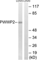 PWWP2B Antibody - Western blot analysis of lysates from LOVO cells, using PWWP2B Antibody. The lane on the right is blocked with the synthesized peptide.