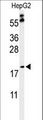 PXMP2 Antibody - Western blot of PXMP2 Antibody in HepG2 cell line lysates (35 ug/lane). PXMP2 (arrow) was detected using the purified antibody.